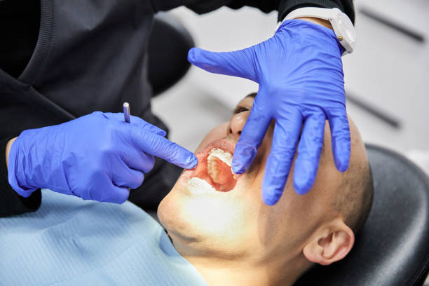 Best Emergency Root Canal Treatment in St Paul, VA