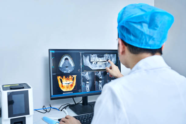Best Emergency Wisdom Teeth Removal in St Paul, VA